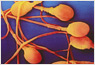 Photo: microscopic image of sperm