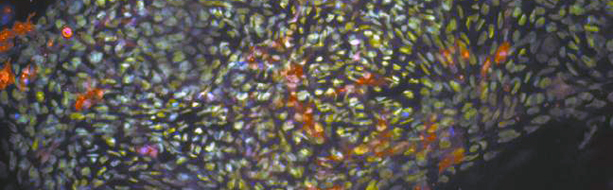 Image: stem cells